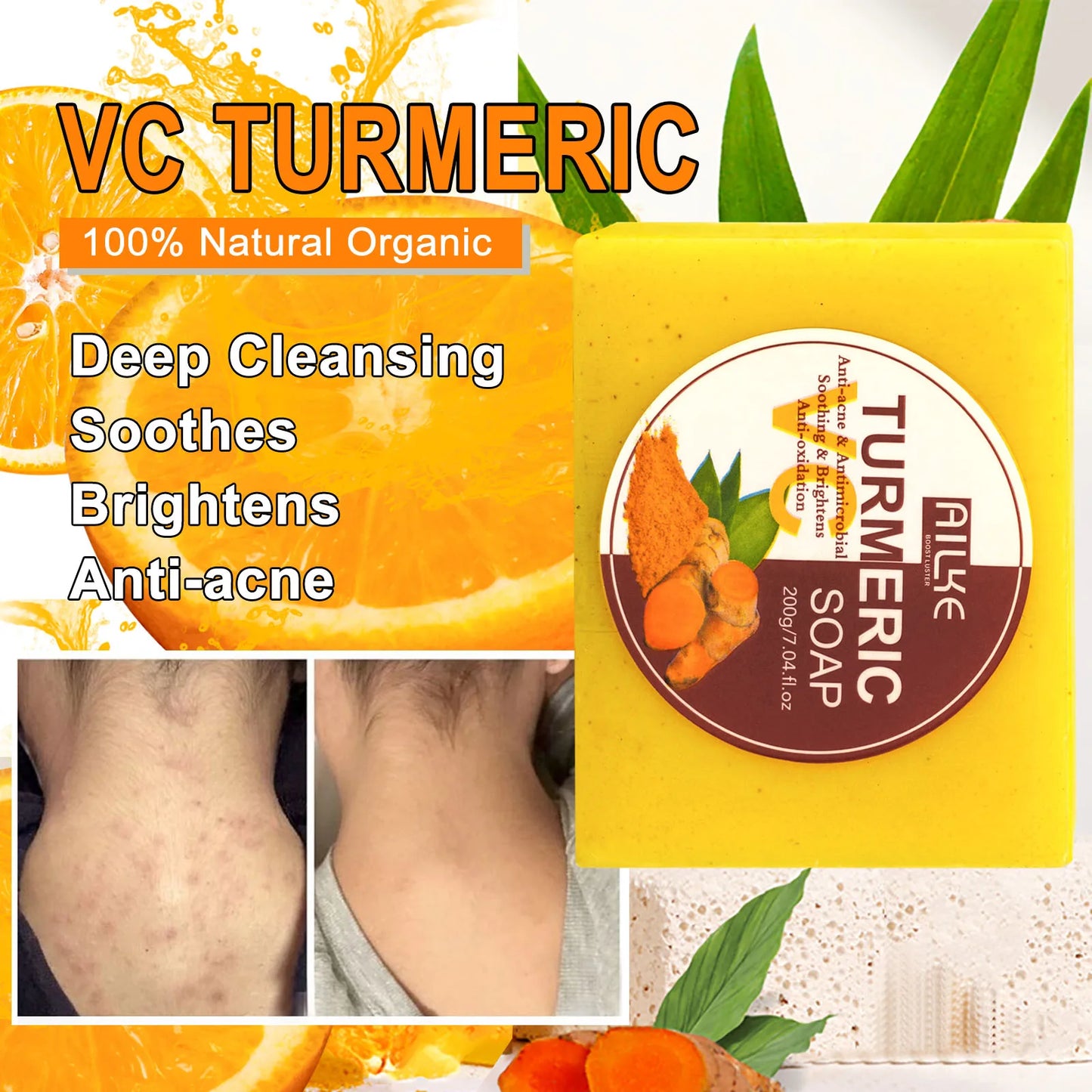 Organic Turmeric Skin Care Kit