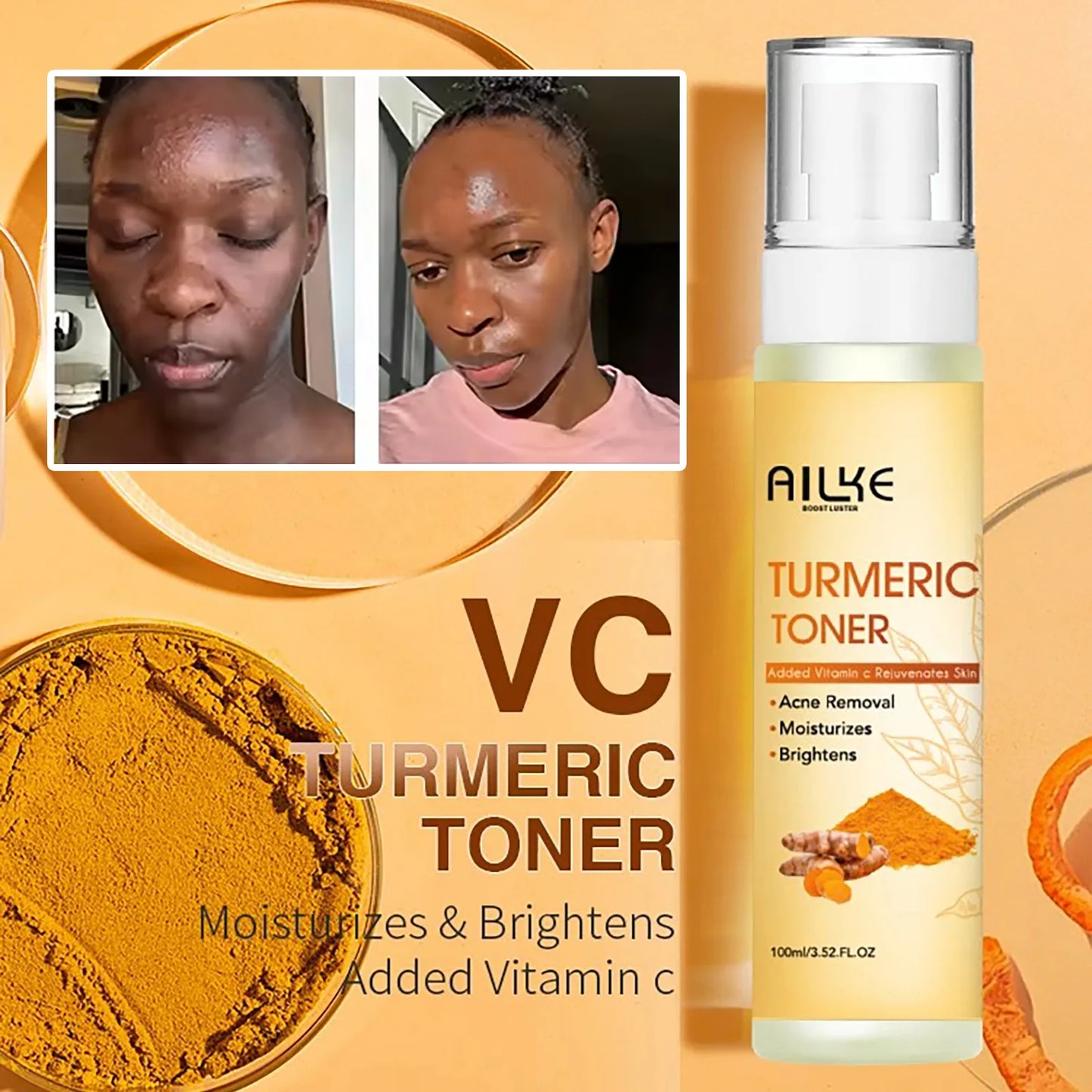 Organic Turmeric Skin Care Kit